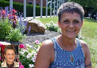 Prosthodontists provides a long lasting smile for beautiful patient