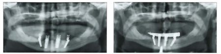2xrays.jpg