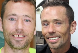 Fig 1: Before -- Fig 7: After