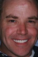 ken-post-treatment-smile.jpg