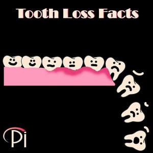 Tooth Loss Facts Graphic