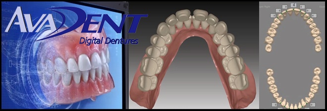 Young people today are choosing dentures
